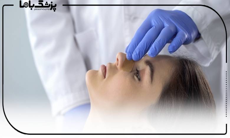 مشاوره با جراح بینی استخوانی در ساری