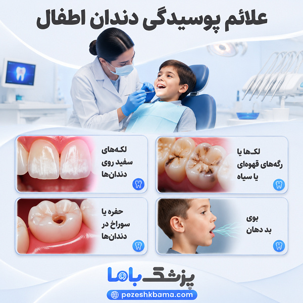 علائم پوسیدگی دندان اطفال