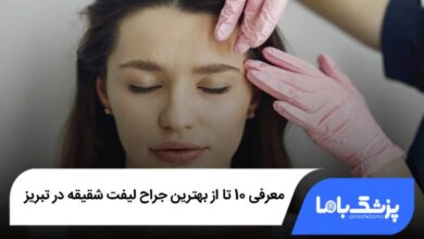 بهترین جراح لیفت شقیقه در تبریز