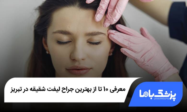 بهترین جراح لیفت شقیقه در تبریز