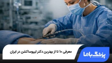 بهترین دکتر لیپوساکشن در ایران