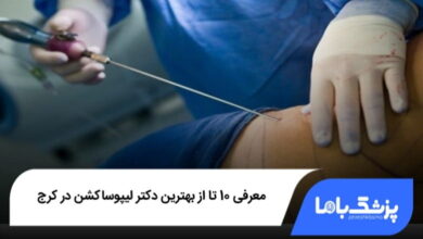 بهترین دکتر لیپوساکشن در کرج