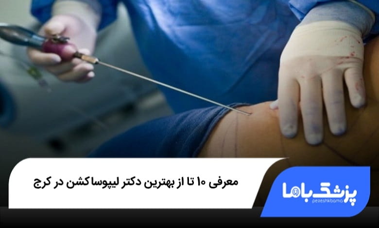 بهترین دکتر لیپوساکشن در کرج