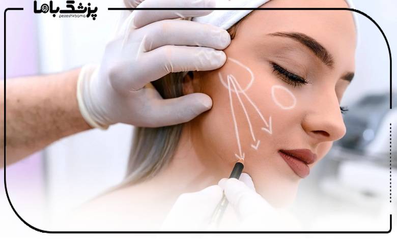 مشاوره با بهترین دکتر بوکال فت در ساری