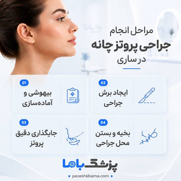 مراحل انجام جراحی پروتز چانه در ساری