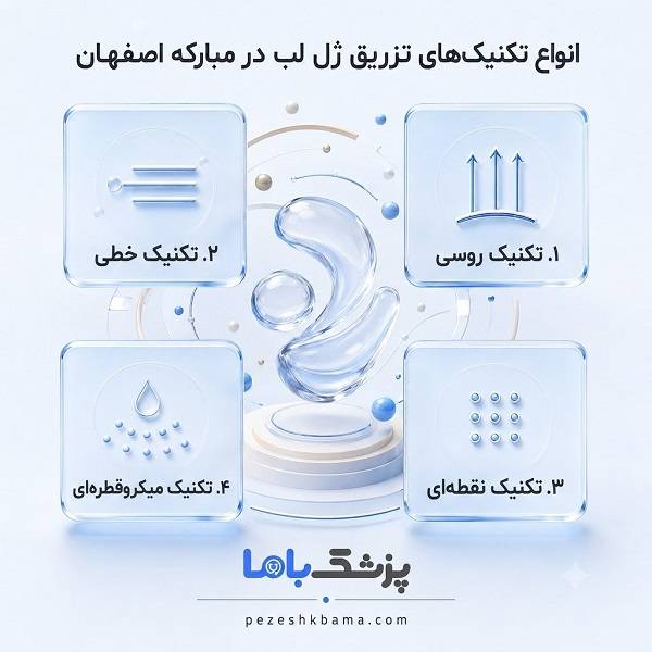 انواع تکنیکهای تزریق ژل لب در مبارکه اصفهان