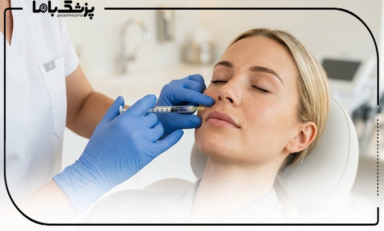 تزریق ژل خط خنده توسط بهترین دکتر تزریق ژل خط خنده در کرج