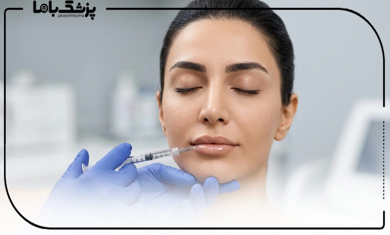 تزریق ژل لب توسط بهترین دکتر ژل لب در ولیعصر