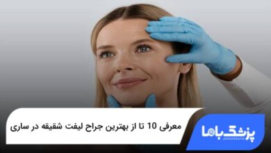 بهترین جراح لیفت شقیقه در ساری