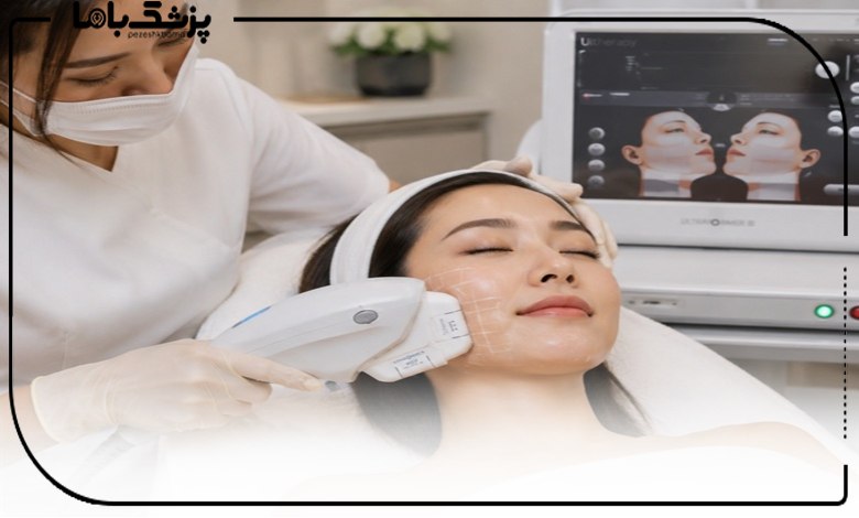 هایفوتراپی صورت در مرکز هایفوتراپی ساری