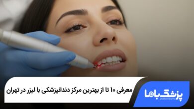 بهترین مرکز دندانپزشکی با لیزر در تهران