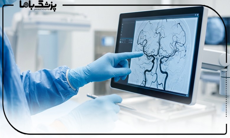بررسی آنژیوگرافی عروق مغز توسط بهترین دکتر آنژیوگرافی در تهران