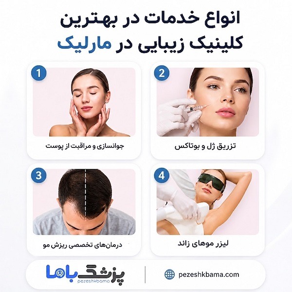 انواع خدمات در بهترین کلینیک زیبایی در مارلیک