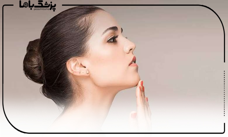 پروتز چانه توسط بهترین جراح پروتز چانه در ساری