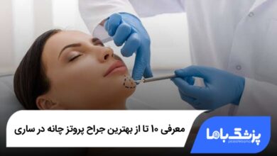 بهترین جراح پروتز چانه در ساری