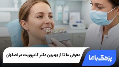بهترین دکتر کامپوزیت در اصفهان
