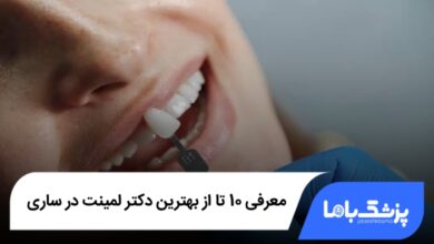 بهترین دکتر لمینت دندان در ساری