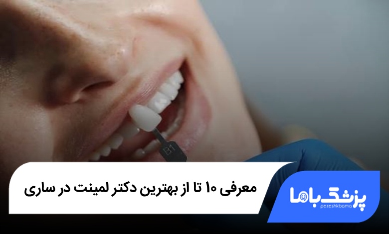 بهترین دکتر لمینت دندان در ساری