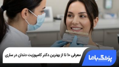 بهترین دکتر کامپوزیت دندان در ساری