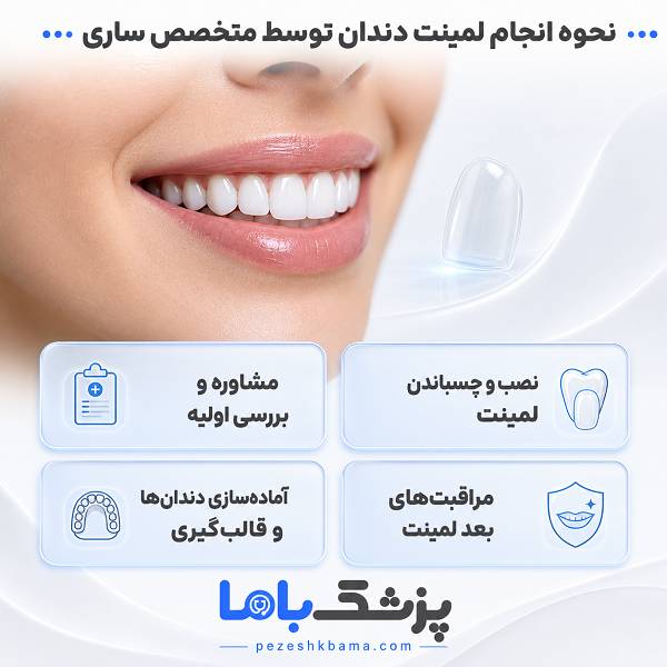 نحوه انجام لمینت دندان توسط متخصص ساری