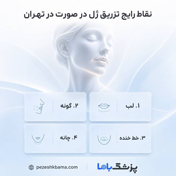 نقاط رایج تزریق ژل در صورت در تهران