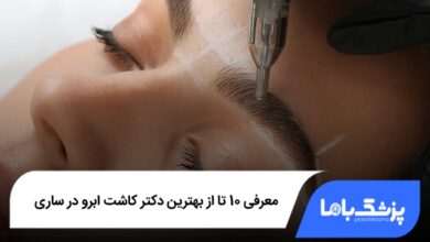 بهترین دکتر کاشت ابرو در ساری