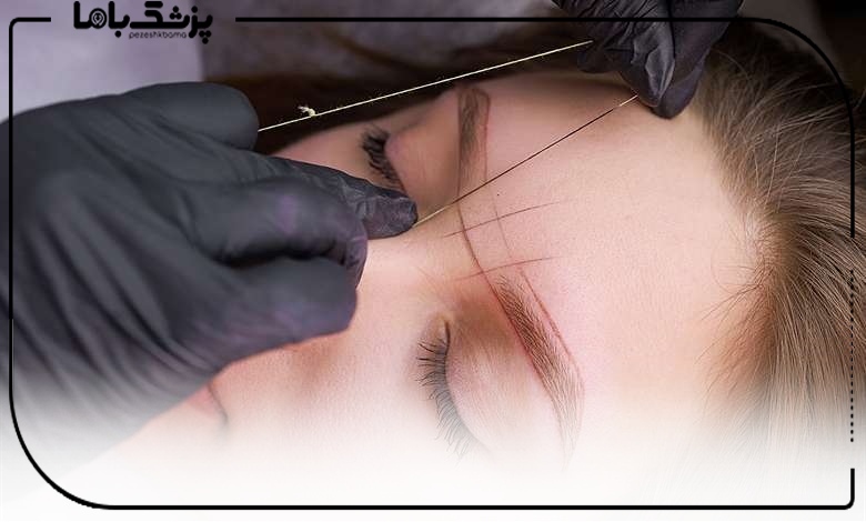 طراحی کاشت ابرو توسط بهترین دکتر کاشت ابرو در ساری