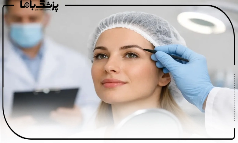 طراحی ابرو توسط دکتر کاشت ابرو تبریز