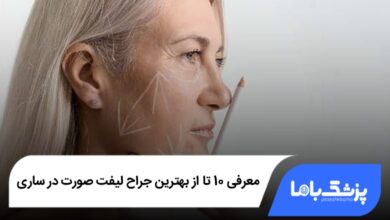 بهترین جراح لیفت صورت در ساری