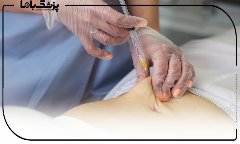 بهترین سن برای تزریق چربی چه زمانی است؟