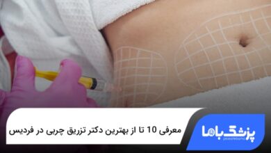 بهترین دکتر تزریق چربی در فردیس