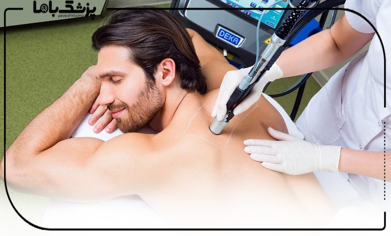 لیزر فول بادی برای چه کسانی مناسبتر است؟