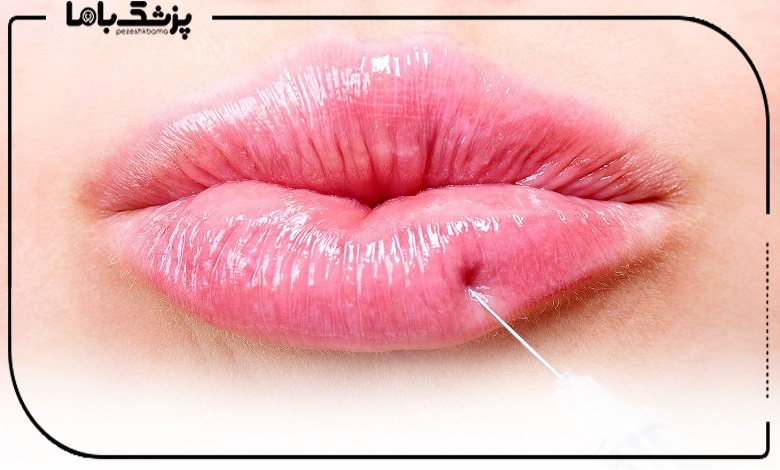 عوارض جانبی تزریق ژل و راههای پیشگیری از آنها