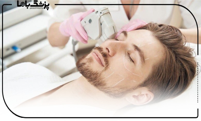 ماندگاری نتایج هایفوتراپی چقدر است؟
