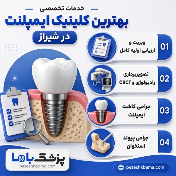 خدمات تخصصی بهترین کلینیک ایمپلنت در شیراز