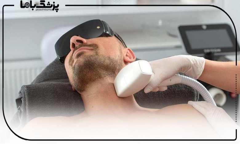 لیزر فول بادی چیست و شامل چه نواحی میشود؟