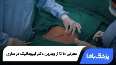 بهترین دکتر لیپوماتیک در ساری