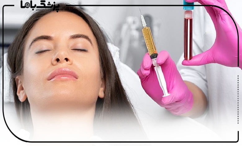 مزوتراپی بهتر است یا PRP؟ مقایسه کامل