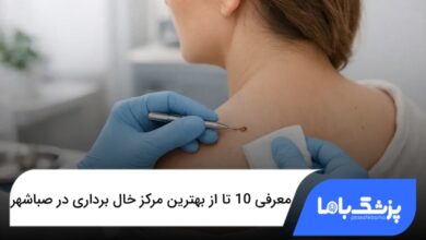 بهترین مرکز خال برداری در صباشهر