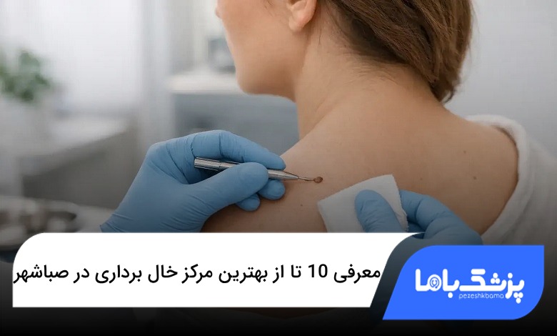بهترین مرکز خال برداری در صباشهر