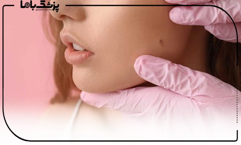 خالبرداری در صباشهر: بررسی 4 روش محبوب و کاربردی