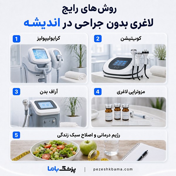 روش های رایج لاغری بدون جراحی در اندیشه