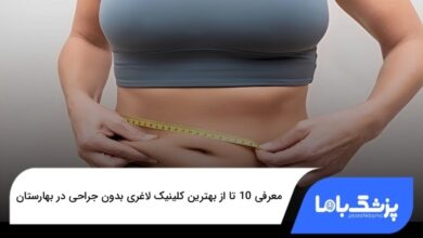 بهترین کلینیک لاغری بدون جراحی در بهارستان