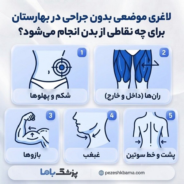لاغری موضعی بدون جراحی در بهارستان برای چه نقاطی از بدن انجام میشود؟