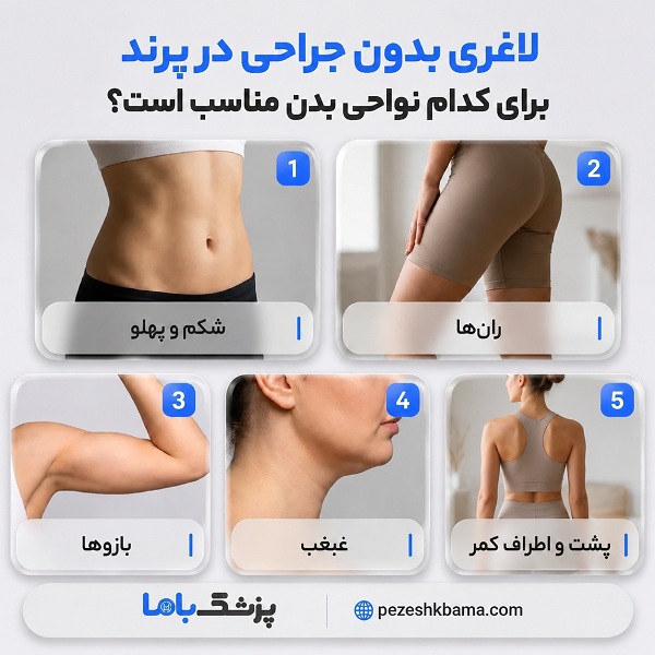 لاغری بدون جراحی در پرند برای کدام نواحی بدن مناسب است؟