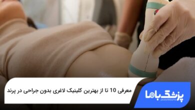 بهترین کلینیک لاغری بدون جراحی در پرند