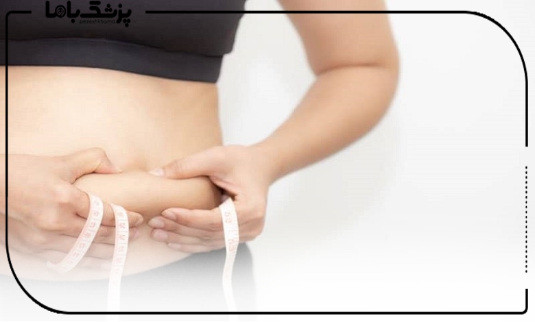 لاغری بدون جراحی با دستگاه های پیشرفته در شهریار