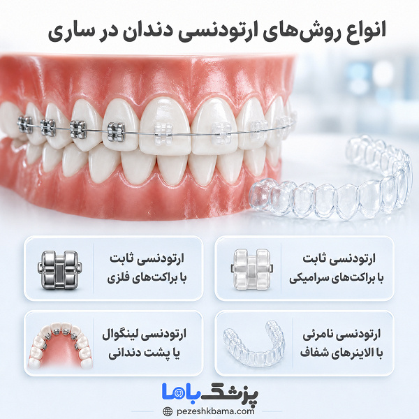 انواع روشهای ارتودنسی دندان در ساری