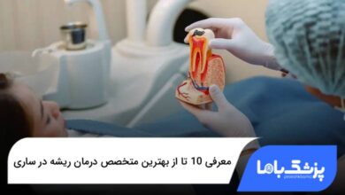 بهترین متخصص درمان ریشه در ساری