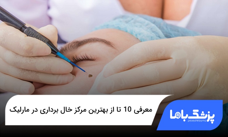 بهترین مرکز خال برداری در مارلیک